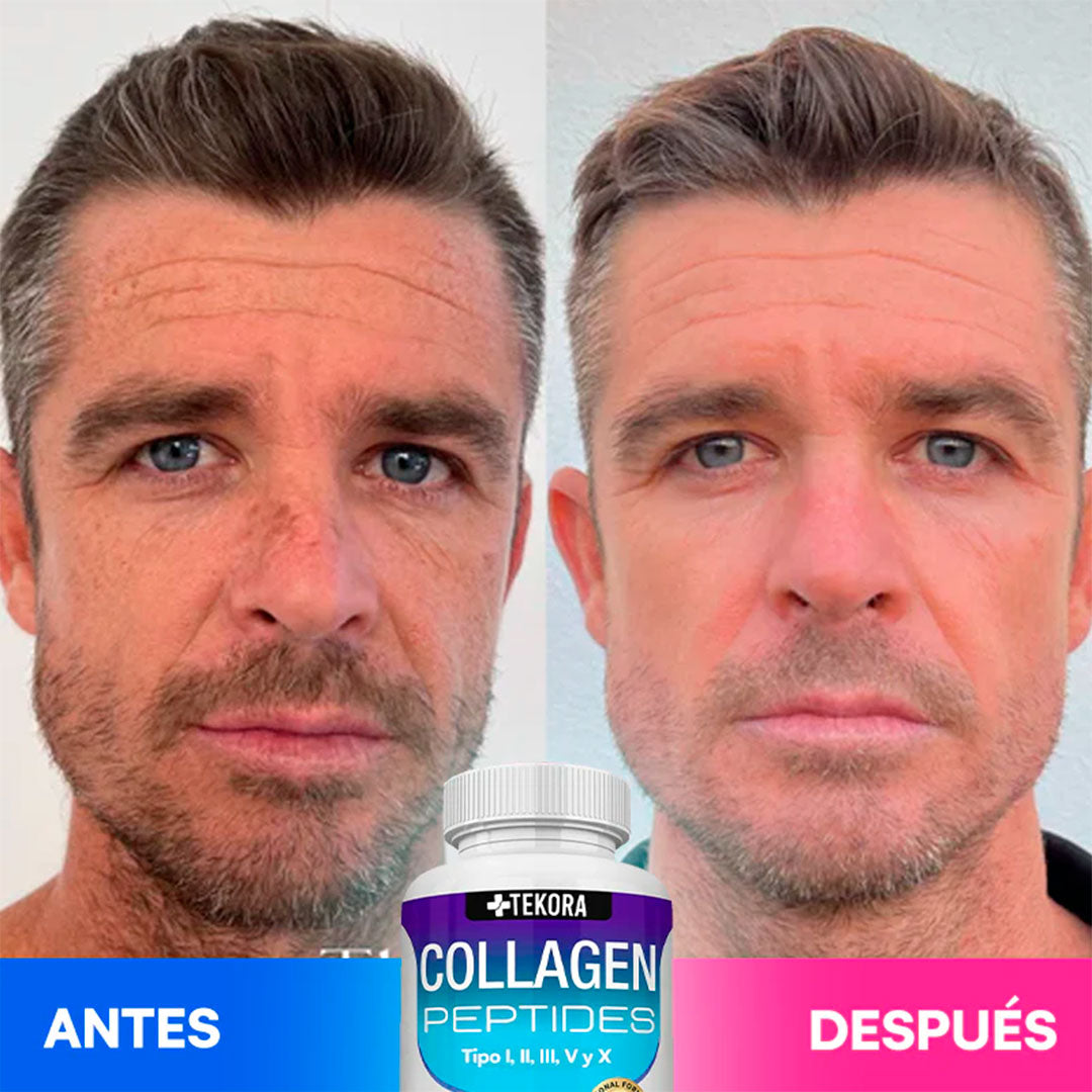 💙 Colágeno 100% Puro Anti-Edad – Fórmula Profesional✨Rejuvenece Tu Piel, Fortalece Tu Cuerpo, Recupera Tu Confianza ✨