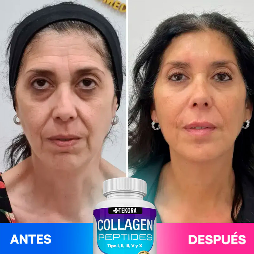 💙 Colágeno 100% Puro Anti-Edad – Fórmula Profesional✨Rejuvenece Tu Piel, Fortalece Tu Cuerpo, Recupera Tu Confianza ✨