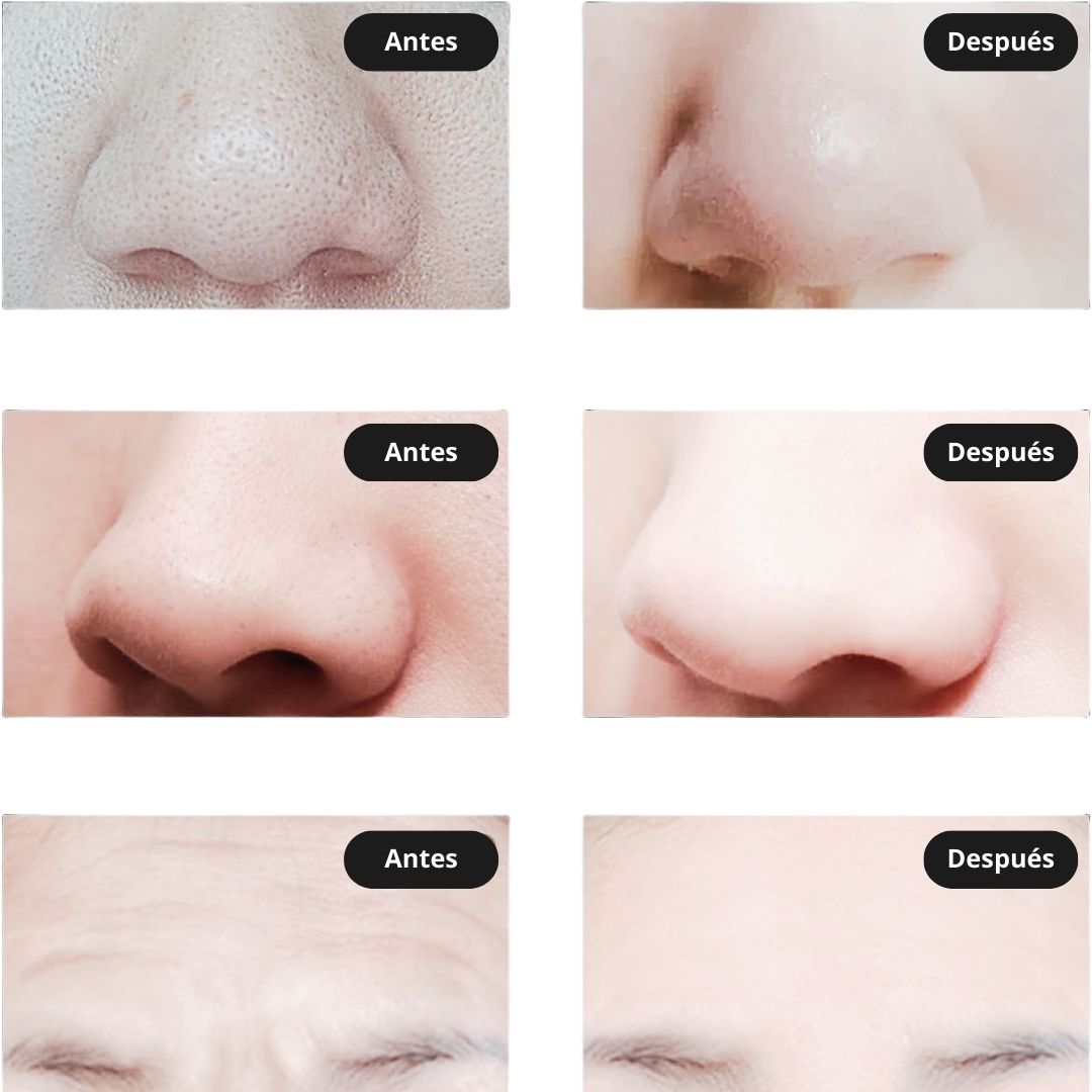 Mascara LED facial 7 colores