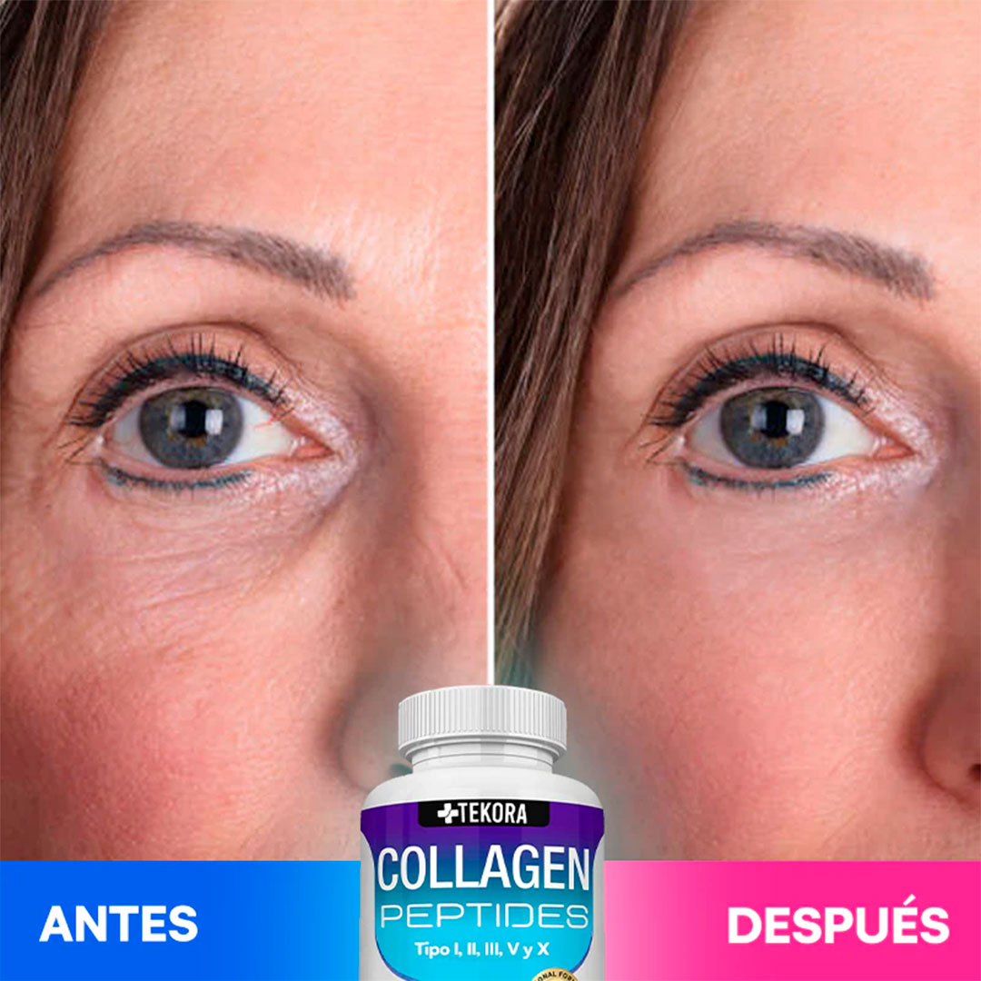 💙 Colágeno 100% Puro Anti-Edad – Fórmula Profesional✨Rejuvenece Tu Piel, Fortalece Tu Cuerpo, Recupera Tu Confianza ✨