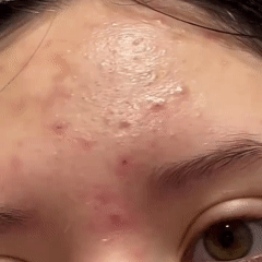 Noni Glow Ampolla ✨Refuerza la idea de energía + brillo + juventud de la piel