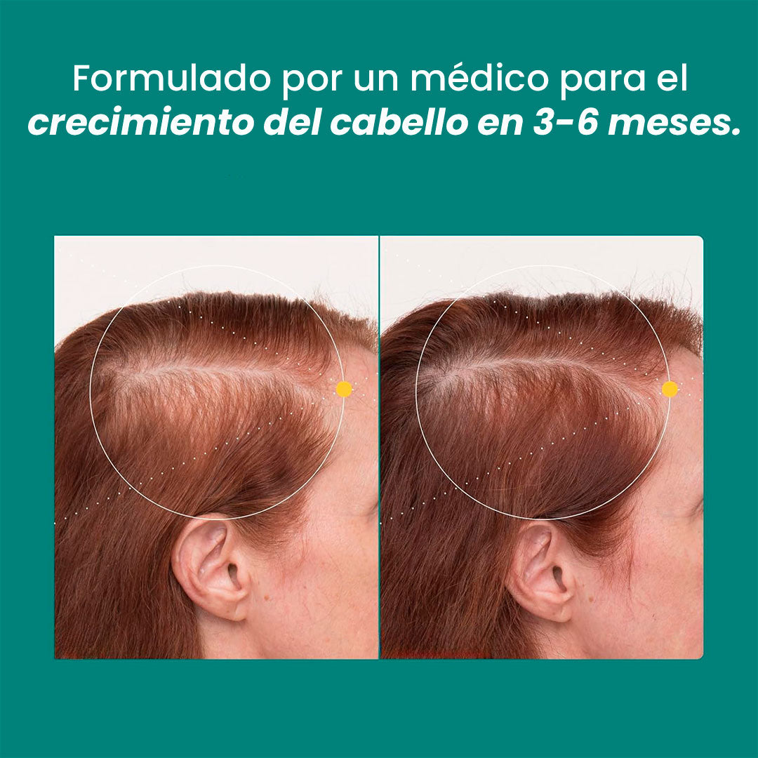 Nutrafol Women's Balance (45+): 💊Suplemento para el Crecimiento Capilar