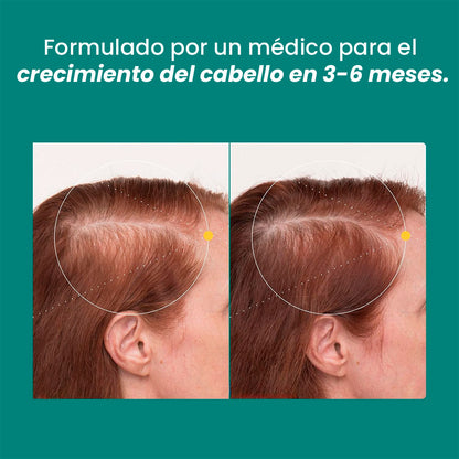 Nutrafol Women's Balance (45+): 💊Suplemento para el Crecimiento Capilar
