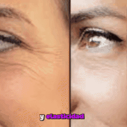Serum antiarrugas con 10% de Hexapéptido