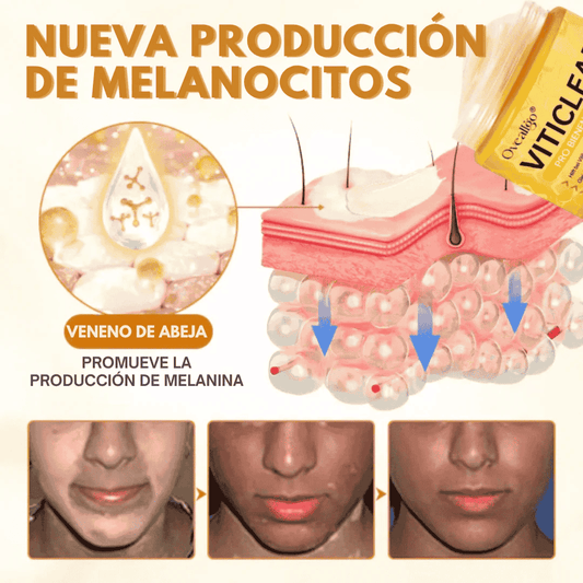VitiClear Pro Crema de veneno de abeja ANTI-MANCHAS 🐝😎